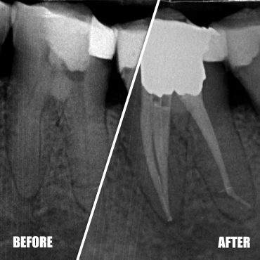 Case 5