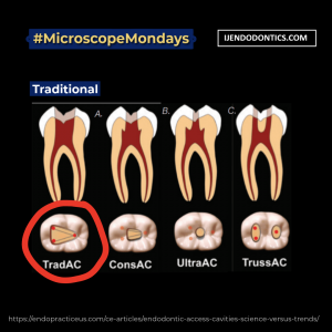 Access cavities